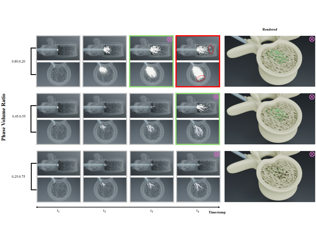 Visual Simulation of Bone Cement Blending and Dynamic Flow